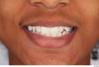 Dejavee Ford teeth 0001.jpg